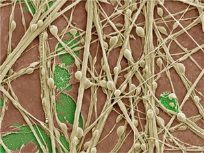 The Radical Consequences of Respiration: Reactive Oxygen Species in Aging and Disease course image