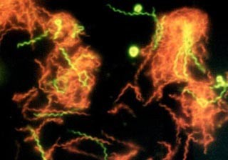 Environmental Microbiology course image