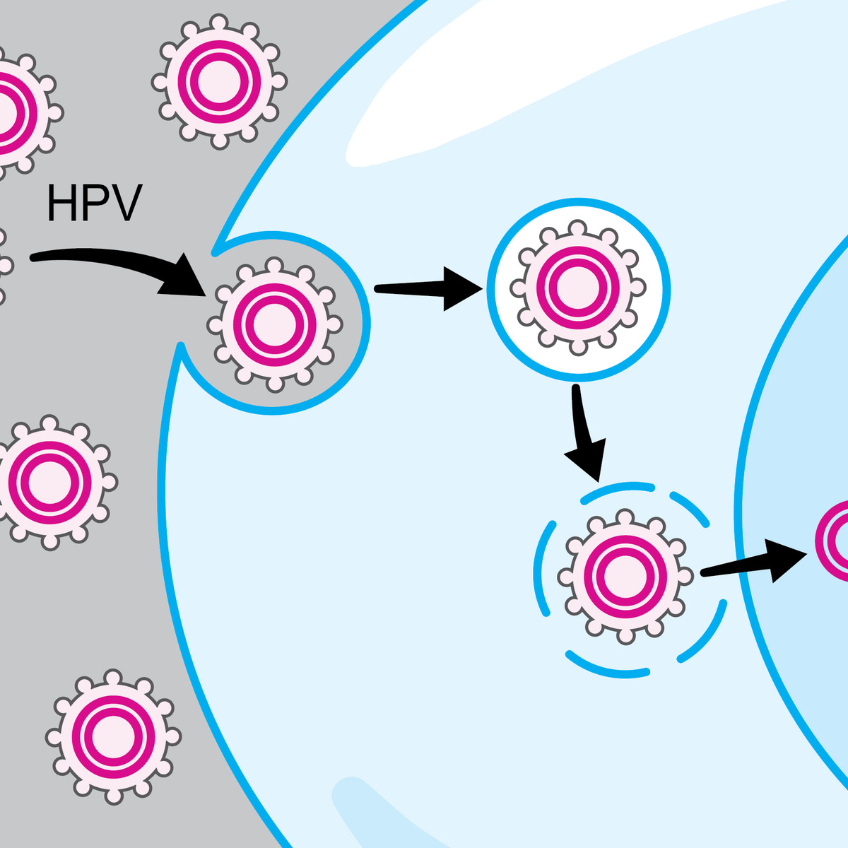 HPV-Associated Oral and Throat Cancer: What You Need to Know course image