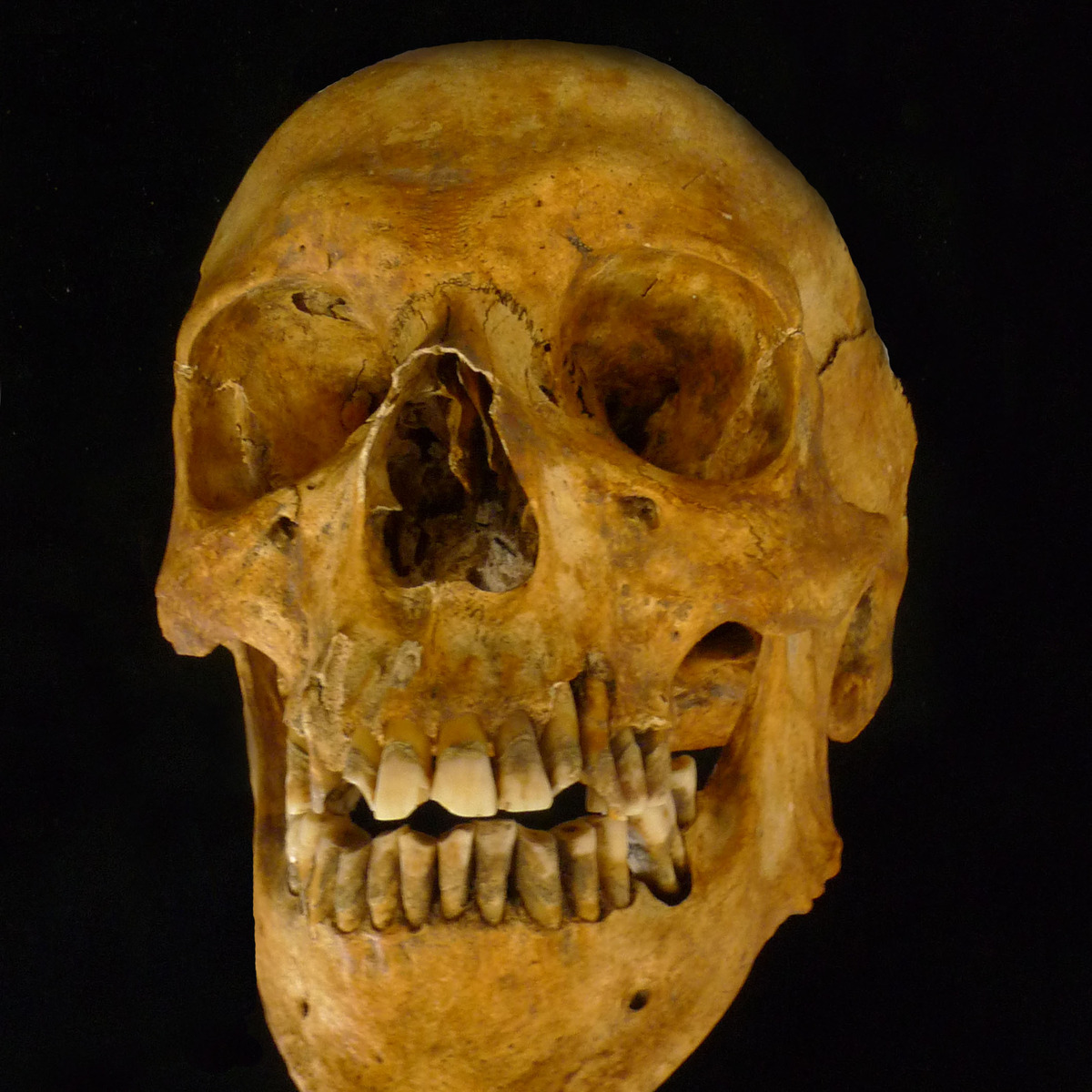 Osteoarchaeology: The Truth in Our Bones course image