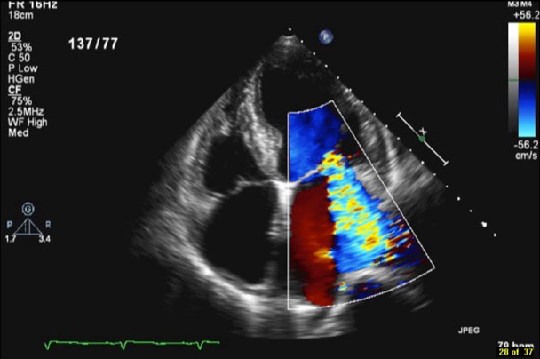 Focused Bedside TTE and Ultrasound course image
