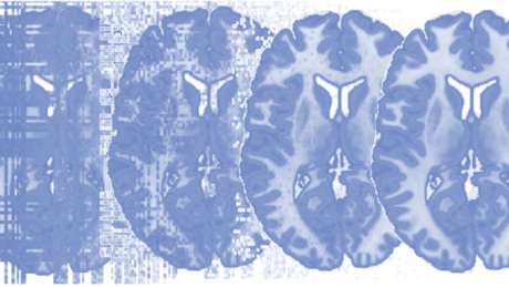 Principles of fMRI 2 course image
