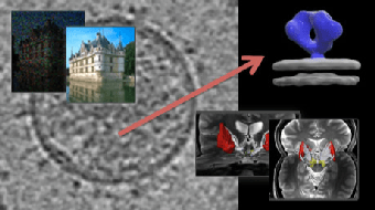 Image and video processing: From Mars to Hollywood with a stop at the hospital course image