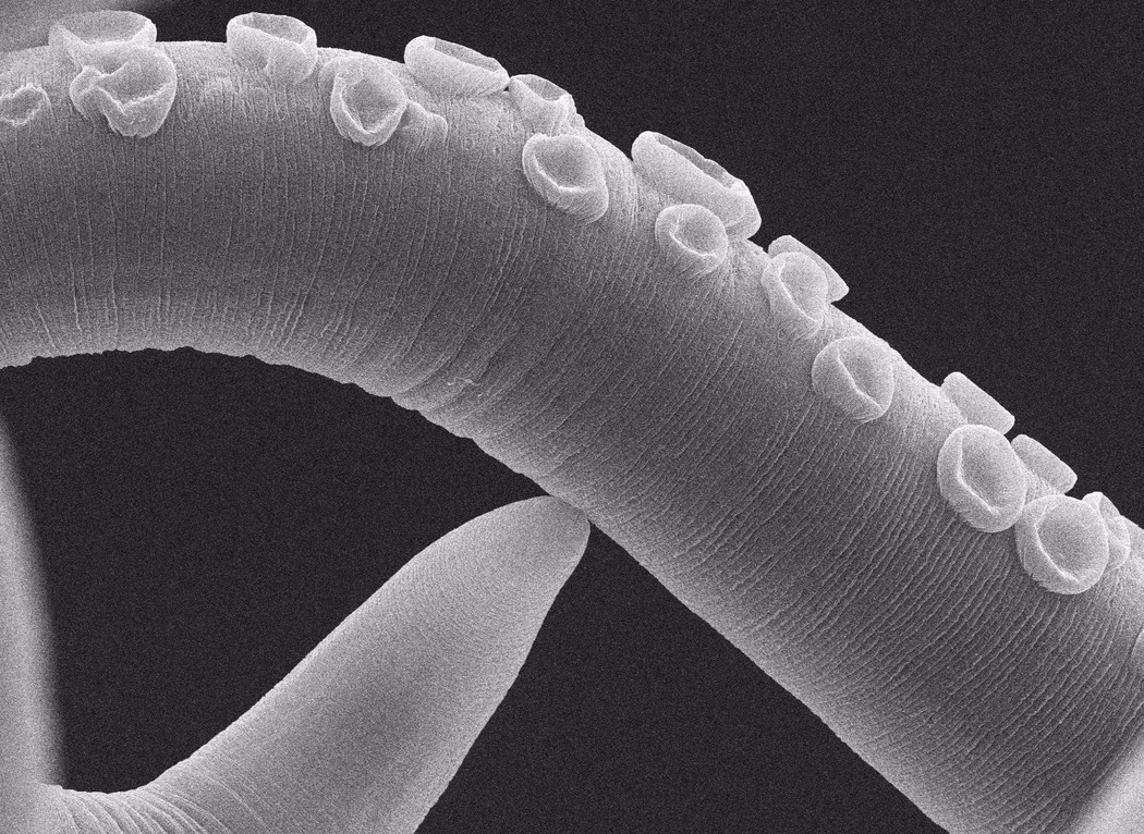 Parasitic Worms: Life Stories course image