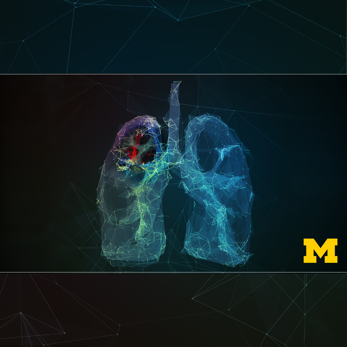 Thoracic Oncology course image