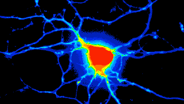 Integrated Analysis in Systems Biology course image